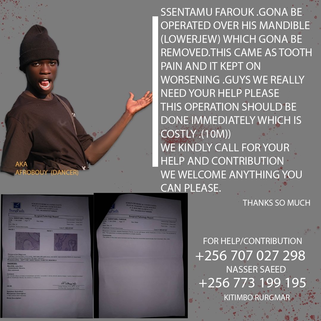 RollinOffical's tweet photo. Hlo family...... Well I humbly seek yr help. Our lital bro here needs yr help in surpoting us in making sure his life gets to normal... It's such a big sum of money but with me and you we can save a life.... https://t.co/4xzAcd713v