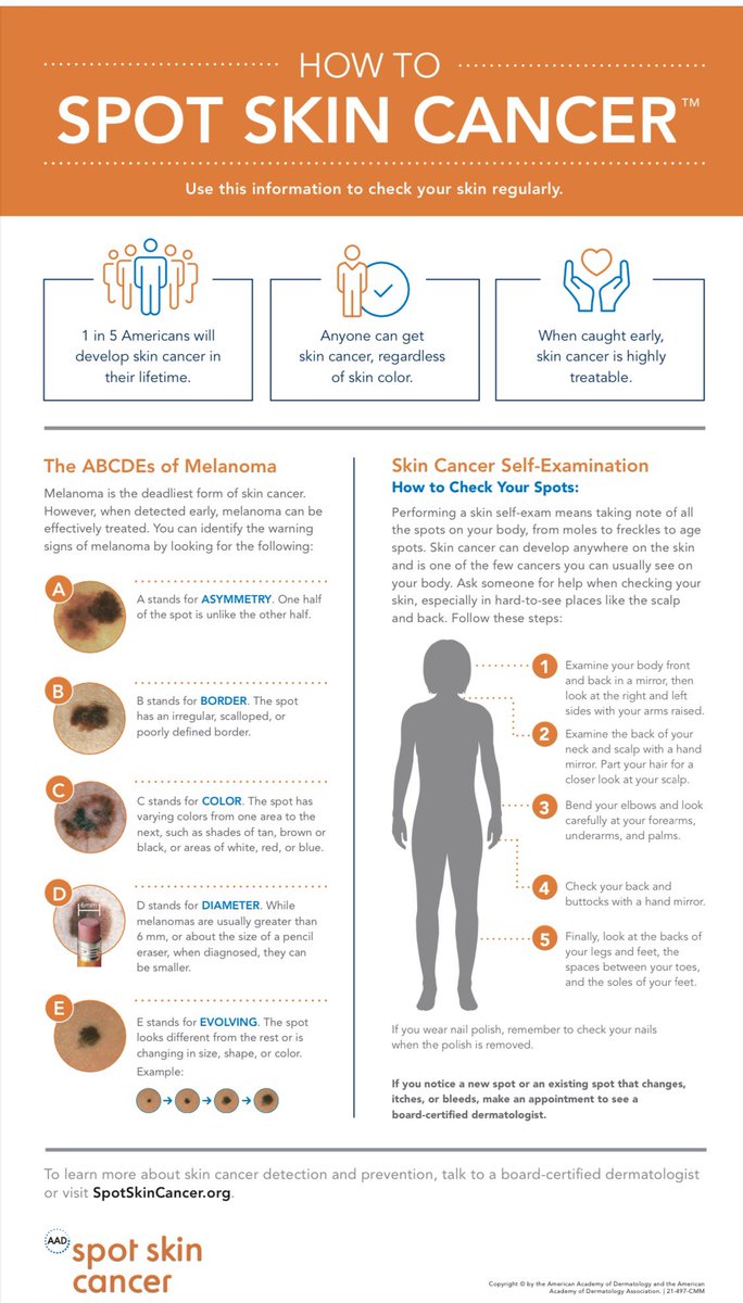 #MelanomaMonday marks the start of #SkinCancerAwarenessMonth. This is your reminder to schedule your #skincancer check + learn your ABCDEs! I’ve been taking care of this lovely patient for years, and at her recent visit found this superficial melanoma. Early detection is key.