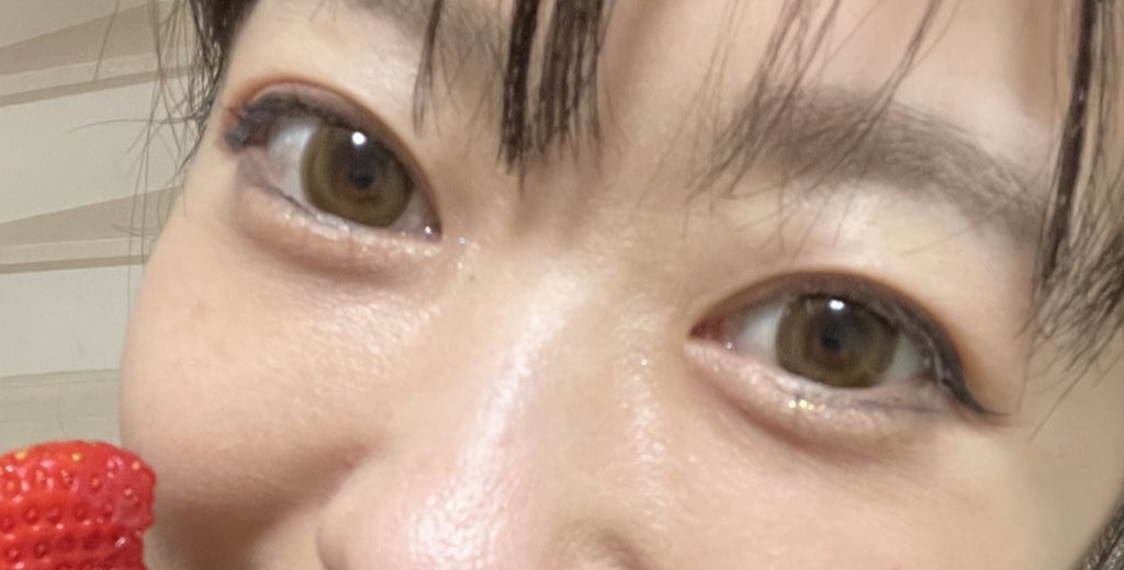 7co5chan's tweet photo. ＼クマ取りまとめ／

クマ取りについて
https://t.co/SgOJE063bL

裏ハムラ＋脂肪注入DT
https://t.co/GGR2iDho75

治療費内訳
https://t.co/tp7PDVxs9A

ダウンタイムと副作用
https://t.co/hrShyxsoZ2

クマ治療3ヶ月経過後
https://t.co/LbB4DPAh2r

YouTubeチャンネル登録してくれたら嬉しいです☺️ https://t.co/IrG6qLN8za