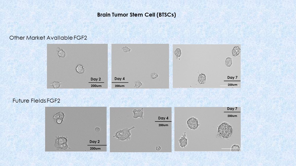 Thakor_Lab's tweet photo. Working on glioblastoma research with brain tumor stem cells (BTSCs). Pictures below are the BTSCs growing with @futurefieldsHQ human FGF2! #MicroPhoto @naanenarasimha https://t.co/DebfLaI7Fg