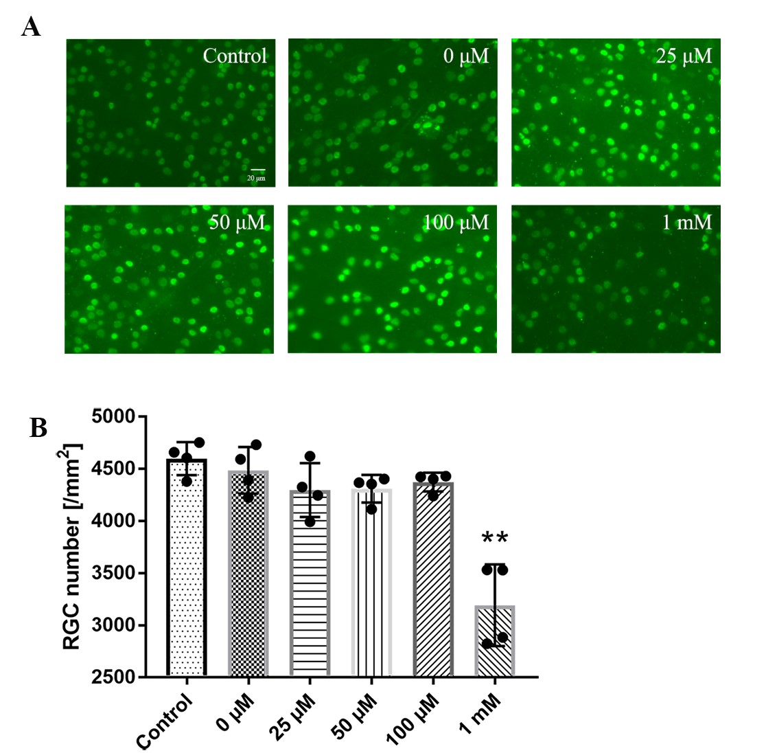 #AOPR
Retinal safety and toxicity study of artesunate in vitro and in vivo @ELS_Ophthal  
sciencedirect.com/science/articl…