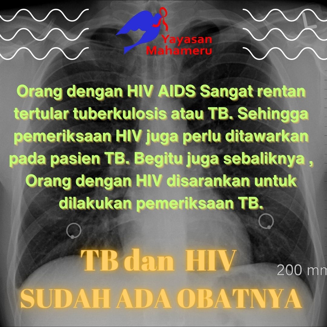 JatimMahameru's tweet photo. TB dan HIV
#yayasanmahameru
#HIV #AIDS #infohiv
#hivtb https://t.co/BJVJvjUXf0