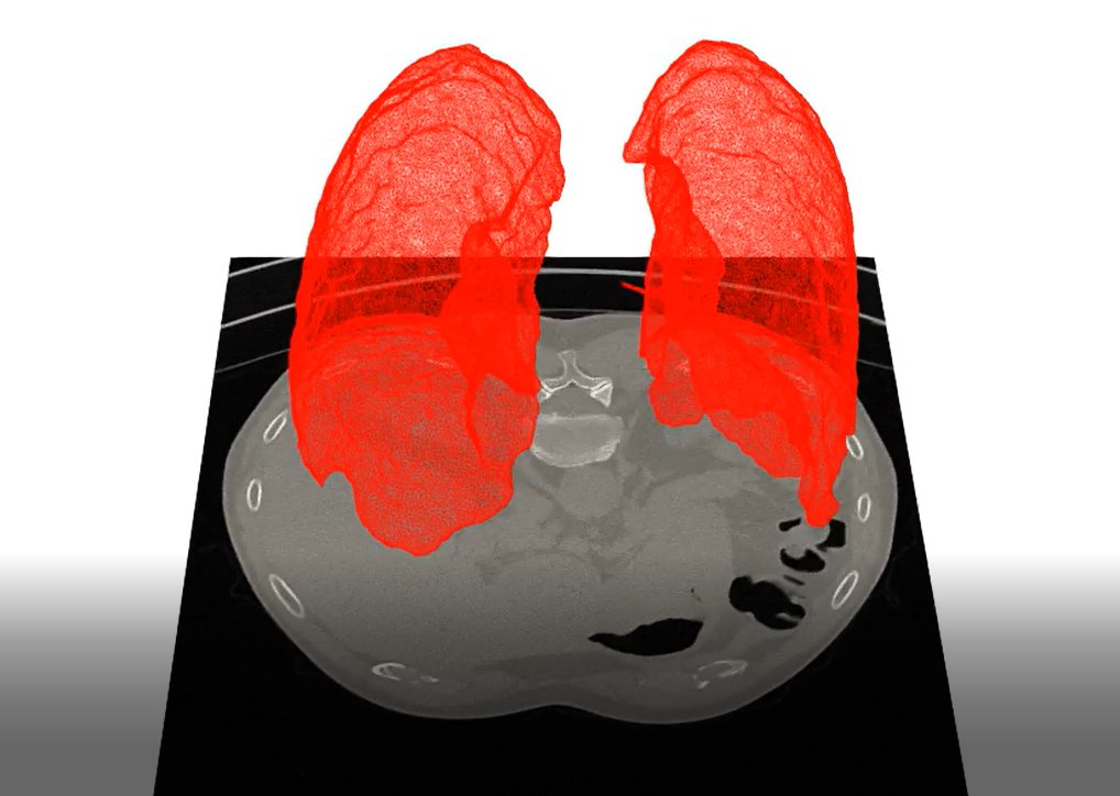 CNRS à Paris-Saclay (@cnrsidfsud) on Twitter photo 🫁👨💻 Une #IA "explicable" pour modéliser finement le poumon et comprendre les pathologies pulmonaires
Le projet #LungManyScale, mené au LMS (<a href="/CNRS/">CNRS 🌍</a> / <a href="/Polytechnique/">École polytechnique</a> et soutenu par l'<a href="/AgenceRecherche/">ANR - Agence nationale de la recherche</a>, développe un véritable "jumeau numérique" du poumon.
▶cutt.ly/y5ZcvUK 🫁👨💻 Une #IA "explicable" pour modéliser finement le poumon et comprendre les pathologies pulmonaires
Le projet #LungManyScale, mené au LMS (<a href="/CNRS/">CNRS 🌍</a> / <a href="/Polytechnique/">École polytechnique</a> et soutenu par l'<a href="/AgenceRecherche/">ANR - Agence nationale de la recherche</a>, développe un véritable "jumeau numérique" du poumon.
▶cutt.ly/y5ZcvUK