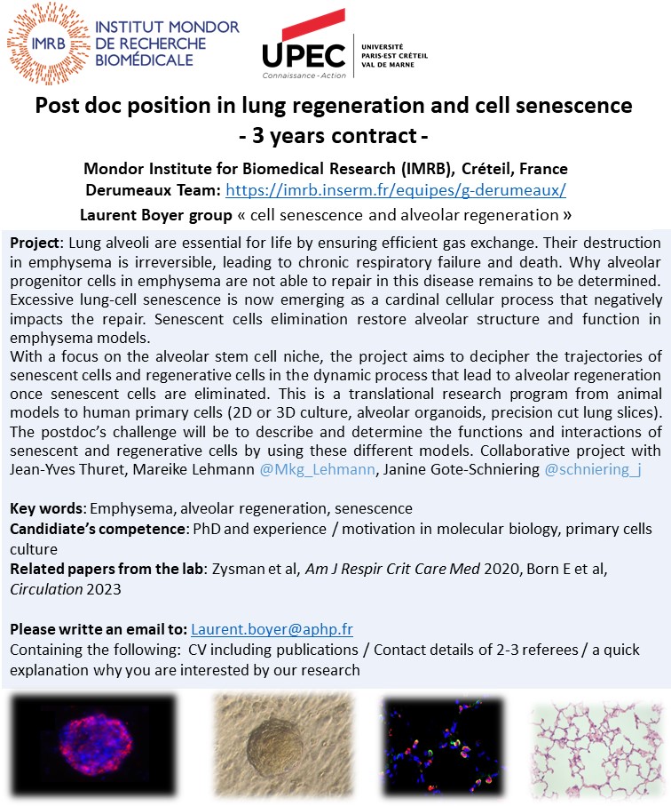 #postdoc position to study cell senescence and alveolar regeneration to cure emphysema  @ East-Paris U, @IMRB_Mondor, France.
Collaborative project with Jean-Yves Thuret, <a href="/Mkg_Lehmann/">Mareike Lehmann</a>, <a href="/schniering_j/">Janine Gote-Schniering</a>
Contact Laurent.boyer@aphp.fr, euraxess.ec.europa.eu/jobs/97499