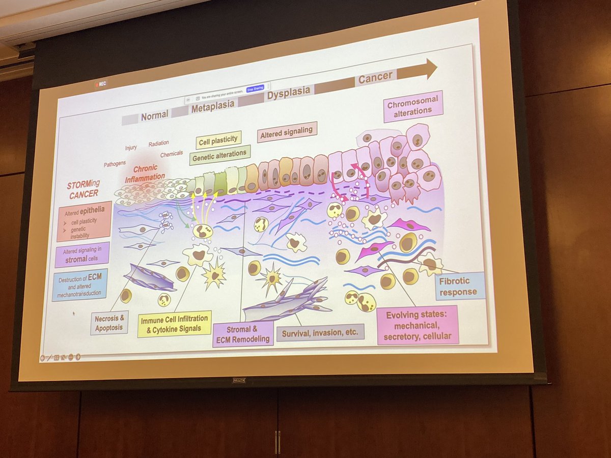 sadhu1012's tweet photo. It’s the day two of the NCI-Sponsored PreCancer Definition workshop where in Dr. Thea Tlsty emphasized the role of stroma in the progression of PreCancer. #NCI #UCSF #precancer #earlydetection https://t.co/XpkgsUr5oO