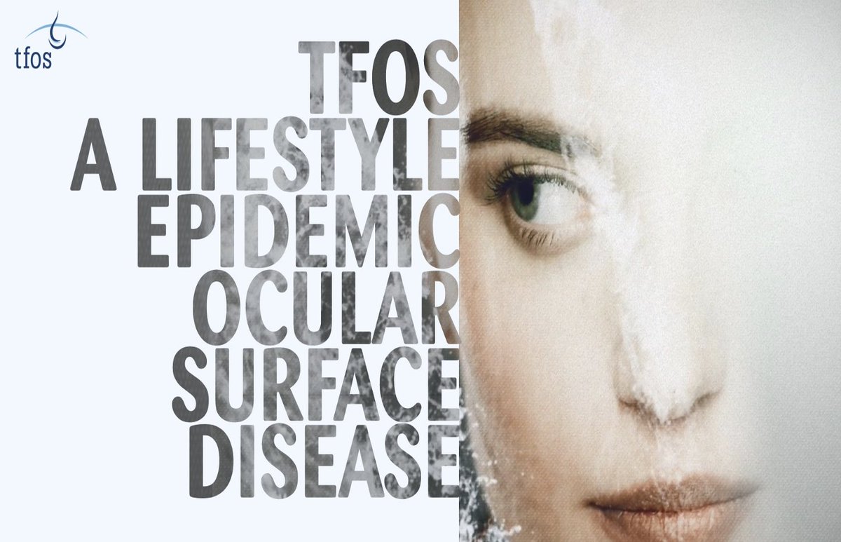 PMFAJournal's tweet photo. The Tear Film & #Ocular Surface Society #TFOS has completed its global Workshop “A Lifestyle Epidemic: Ocular Surface Disease.”
Join May 6-7 to hear the conclusions and recommendations of the Subcommittee reports: https://t.co/3C8cjQlPZb
#PMFA #PMFAJournal #Ophthalmology https://t.co/CoOuHkMjpW