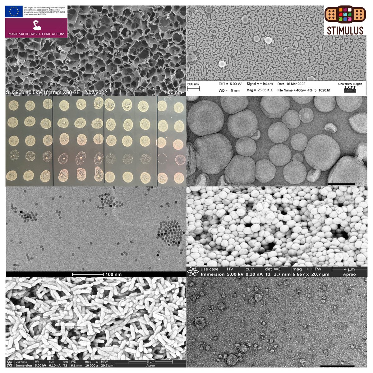 ESR_STIMULUS's tweet photo. SCIEEEEENCE !
Hydrogels, vesicles, nanoparticles or even bacteria can be observed here with SEM, TEM, FE SEM characterization or just with a camera 👩🏽‍🔬🧫🧪
Our ESRs are on it !! https://t.co/atizTUk02I