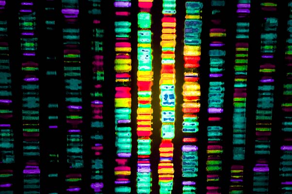 RCPath's tweet image. “Gene therapy represents a natural progression in treatment... the future aim is to provide the patient with the genetic code to produce endogenous factor...” @bcndoc @RoyalLondonHosp Get the latest on #haemophilia and gene therapy in our April Bulletin. ow.ly/AWlZ50NQggg
