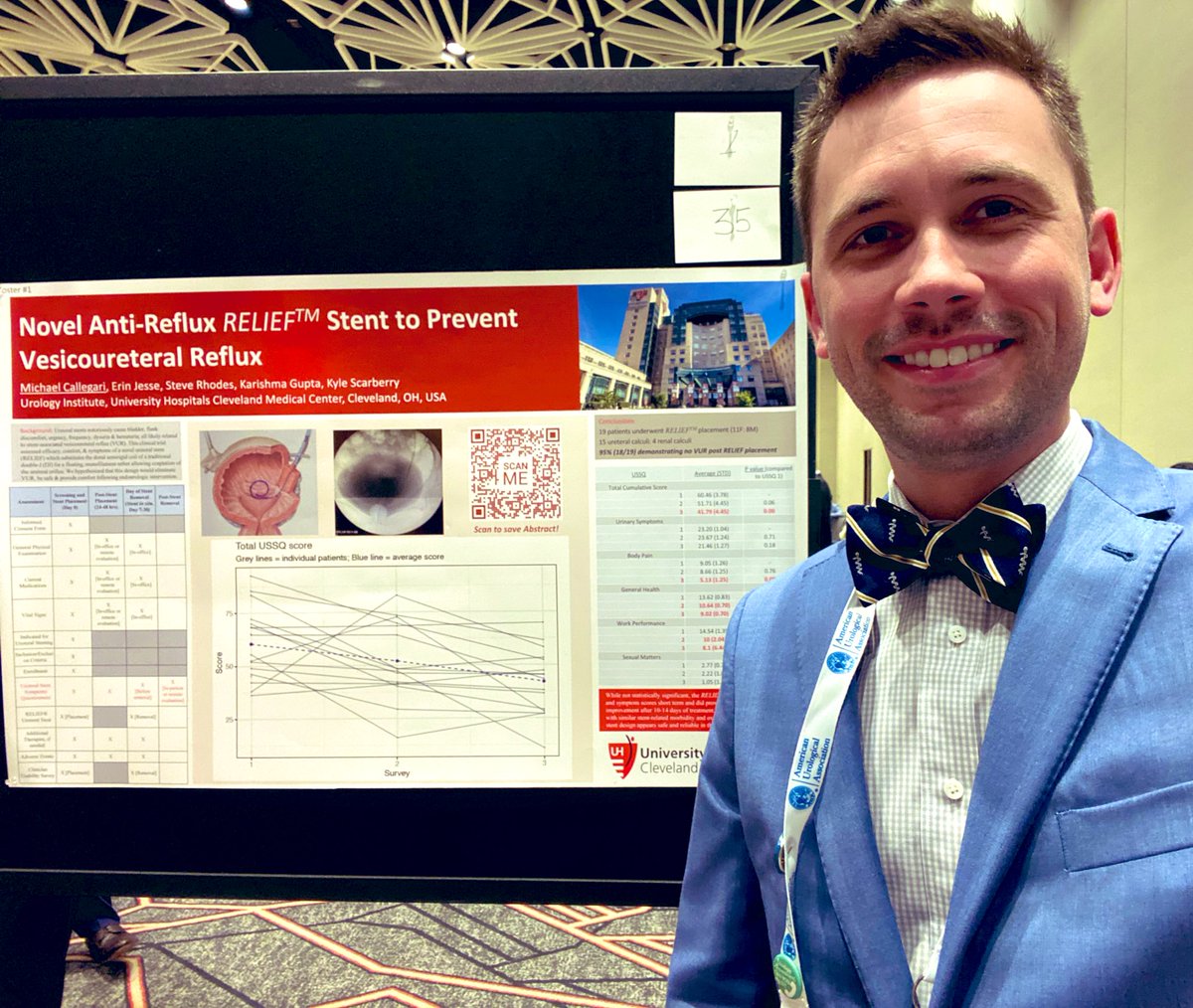michael callegari (@mjjcallegari) on Twitter photo Sharing innovation, experience and encouraging results with our novel anti reflux “RELIEF” ureteral stent at #AUA23 - <a href="/Endo_Society/">Endourological Society</a> <a href="/AmerUrological/">Amer. Urol. Assn.</a> <a href="/erinjessse/">Erin Jesse</a> @stephenrho <a href="/karishma_uro/">Karishma Gupta</a> <a href="/kscarberryMD/">Kyle Scarberry</a> Sharing innovation, experience and encouraging results with our novel anti reflux “RELIEF” ureteral stent at #AUA23 - <a href="/Endo_Society/">Endourological Society</a> <a href="/AmerUrological/">Amer. Urol. Assn.</a> <a href="/erinjessse/">Erin Jesse</a> @stephenrho <a href="/karishma_uro/">Karishma Gupta</a> <a href="/kscarberryMD/">Kyle Scarberry</a>