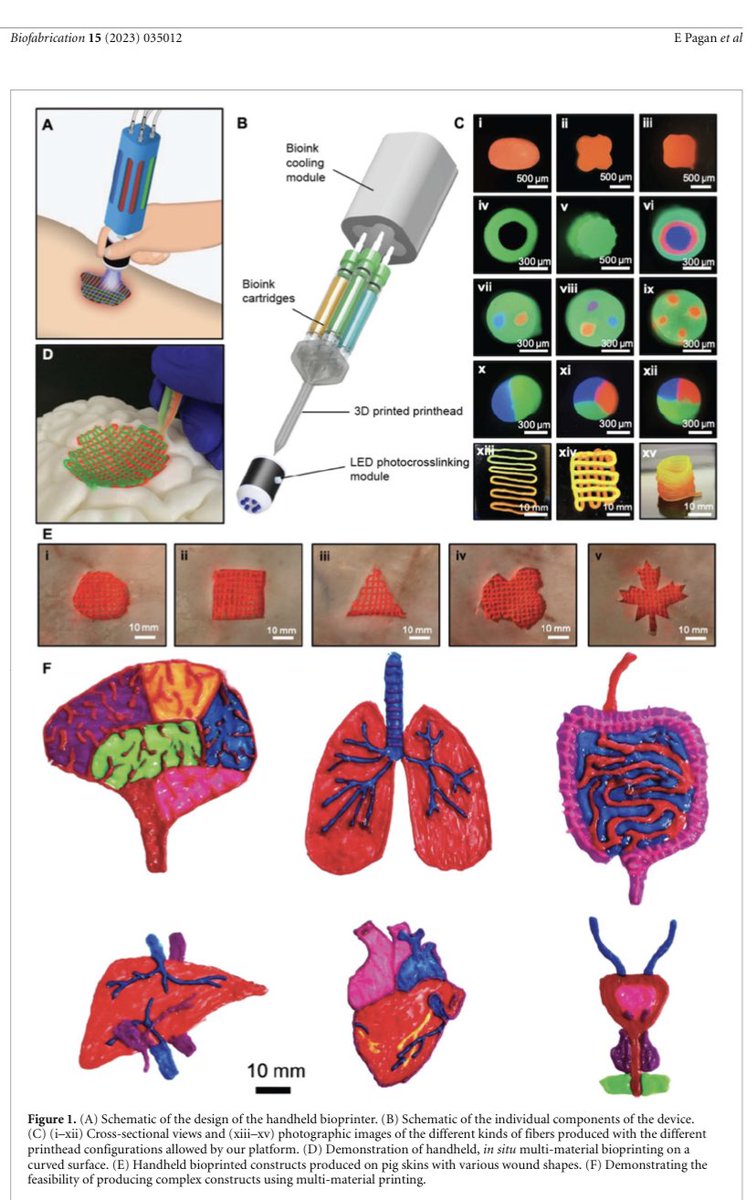 Happy to share our recent publication that reports on a handheld #bioprinter that prints multi-material constructs with different shapes from a wide range of #bioinks. Details of this technology can be freely accessed from the following link: iopscience.iop.org/article/10.108….