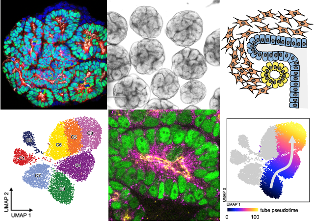Katja Roeper (@katjaroeper) on Twitter photo New lab adventure! Our first paper in a new tube morphogenesis system, nephron formation in human renal organoids from iPSCs, check out our multi-ome and functional analysis of early polarisation and MET biorxiv.org/content/10.110… <a href="/CellBiol_MRCLMB/">MRC-LMB Cell Biology</a> New lab adventure! Our first paper in a new tube morphogenesis system, nephron formation in human renal organoids from iPSCs, check out our multi-ome and functional analysis of early polarisation and MET biorxiv.org/content/10.110… <a href="/CellBiol_MRCLMB/">MRC-LMB Cell Biology</a>