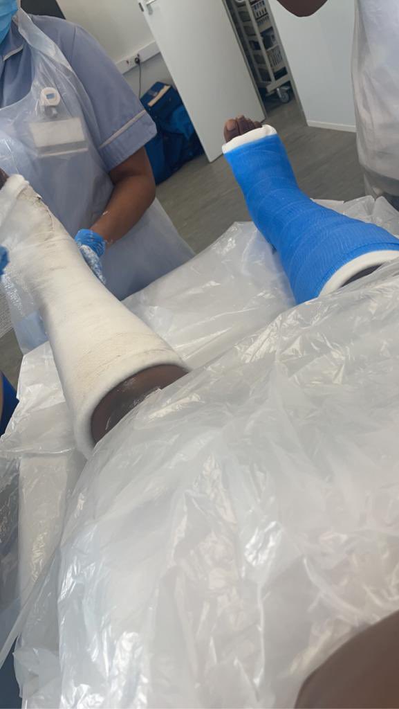 We run regular plaster drop in sessions for staff to practice their plaster and soft wrap casts. Student nurses always happy to volunteer 👍🏼😂 #lri #nursingeducation #nursingskills