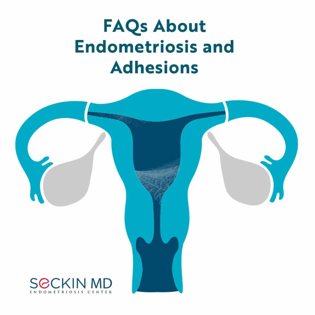 Do you have any more questions about #endometriosis and #adhesions? Please do not hesitate to ask by leaving a comment on our post. Read More: drseckin.com/faqs-about-end…