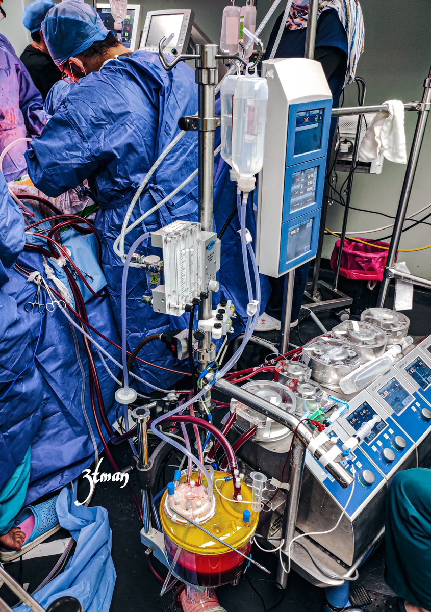 heart lung Machine:تقنية تؤدي عمل القلب والرئتين بشكل مؤقت أثناء العملية الجراحية عبر المحافظة على جريان الدم والأكسجين.
Open Heart Operation 
CABG 🫀🩻 🩵