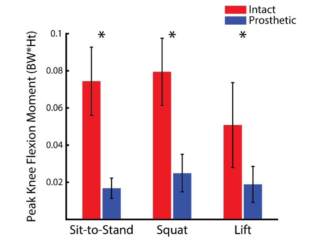 Karl Zelik (@karlzelik) on Twitter photo 🚨 New preprint on #biomechanics & #prosthetics
How much do unilateral transtibial prosthesis users overload their intact limb during activities of daily living like sit-to-stand, reaching & lunging?
A LOT. More than I expected.
<a href="/rachelteater21/">Rachel Teater</a> <a href="/DerekNWolf/">Derek Wolf</a> @KirstyAMcDonald 🚨 New preprint on #biomechanics & #prosthetics
How much do unilateral transtibial prosthesis users overload their intact limb during activities of daily living like sit-to-stand, reaching & lunging?
A LOT. More than I expected.
<a href="/rachelteater21/">Rachel Teater</a> <a href="/DerekNWolf/">Derek Wolf</a> @KirstyAMcDonald