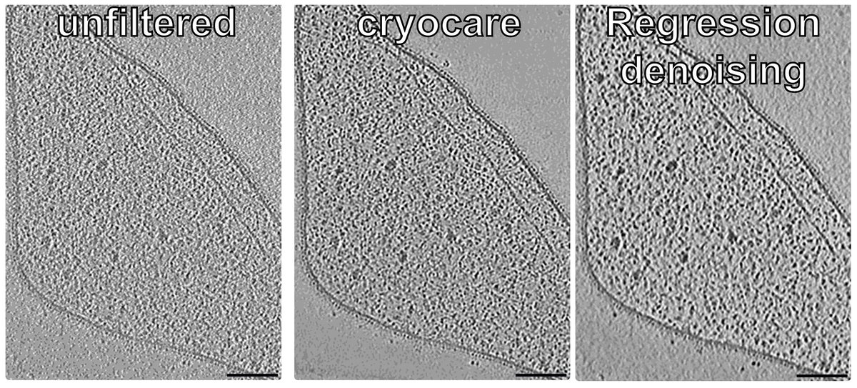 And it also works with Asgard archaea tomograms😍 Regression denoising alias #deepclean produced beautiful results and @SwuliusLab was extremely helpful in setting it up. Thanks for sharing this powerful tool with us #teamtomo 🙏Here is a little comparison: 🧐🤓