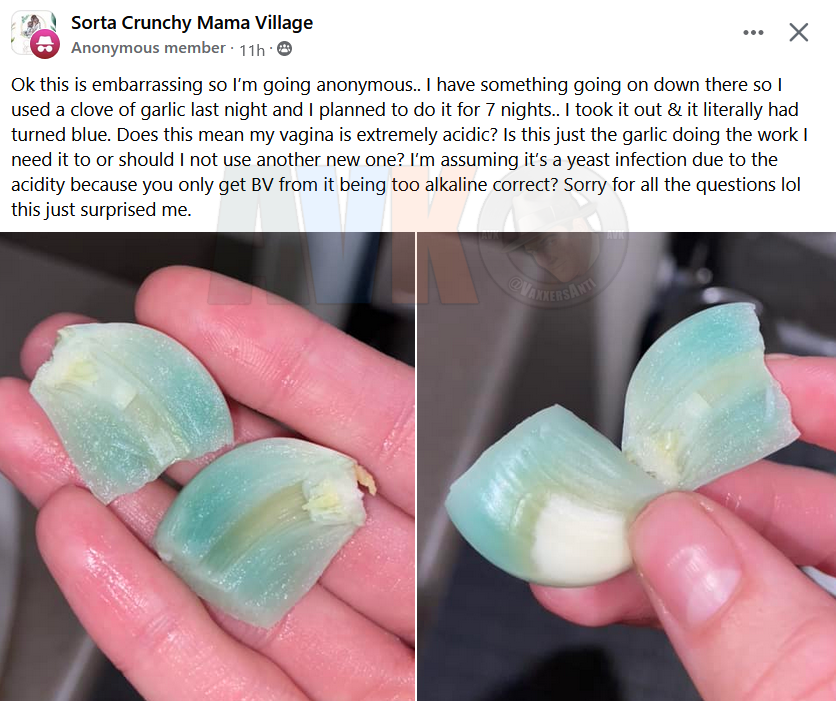 AVK on Twitter "Woman shoved a clove of garlic up her hooha overnight