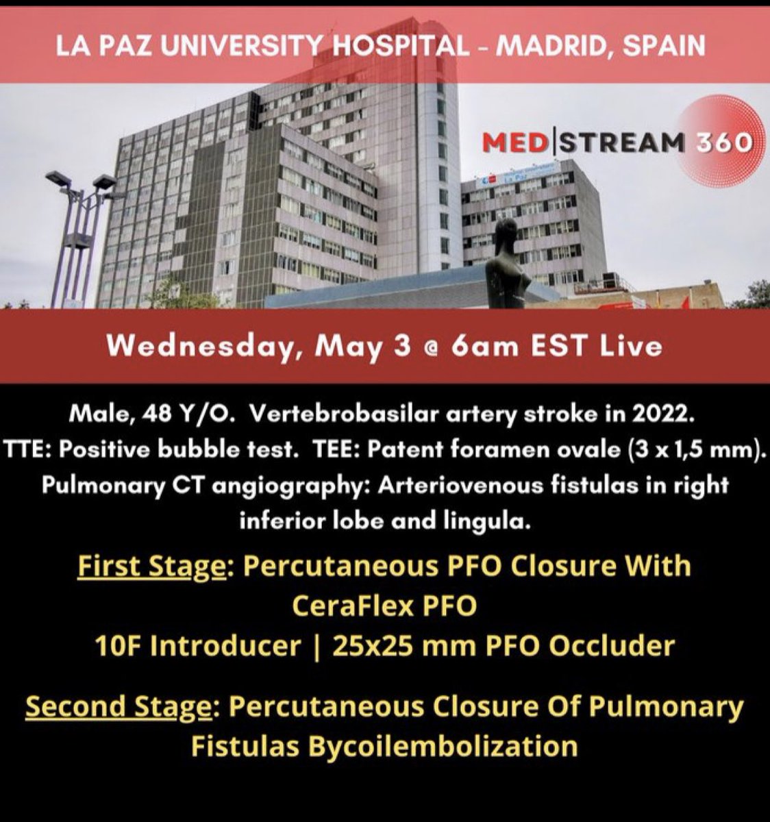 IberiaSmt's tweet image. Caso en vivo en @MedStream360 desde @Hemodin_LaPaz mañana miércoles 3/5 a las 12:00pm
#SMTIb #Lifetech Disclaimer: CERAFLEX is a trademark of Lifetech Scientific Co., Ltd. (&quot;Lifetech &quot;). SMT Iberia is the authorised distributor of Lifetech for Spain.