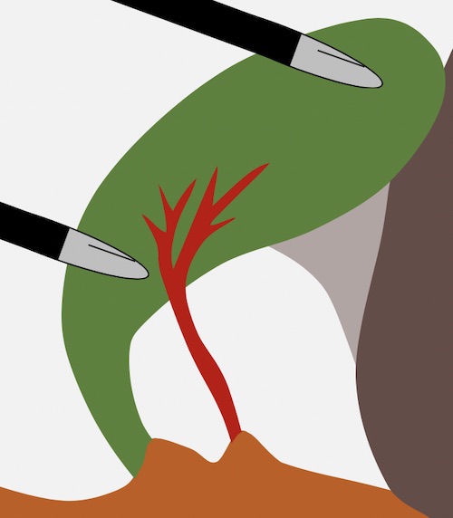 OperativeReview's tweet image. Check out our latest article covering cholecystectomy. A high-yield review of techniques, management strategies for the difficult gallbladder, and complications.

operativereview.com/cholecystectom…

#MedEd #SoMe4Surgery