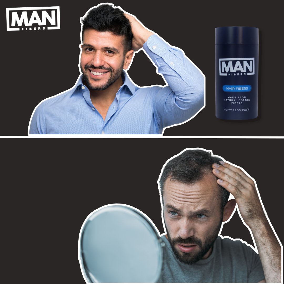 Manfibers's tweet photo. would you like to find out more about what you would look like if you was not balding? 

 #manfibers | #hairloss | #haircare | #balding | #smallbusiness https://t.co/z0R0EkiVWS
