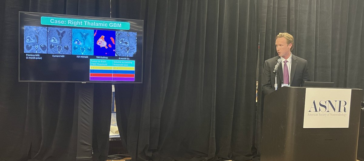 mveronesi07's tweet photo. Andrew Gauger Representing the IU amino acid PET MR research group on brain tumors at today’s ASNR scientific presentation. Well done!
@IURadiology @IUCancerCenter #neuroradiology #braincancer #nucmed #ASNR2023 @jana_ivanidze @Ali_Nabavizadeh @MariamAboian @LabBarajas https://t.co/WgTJEfmfkB