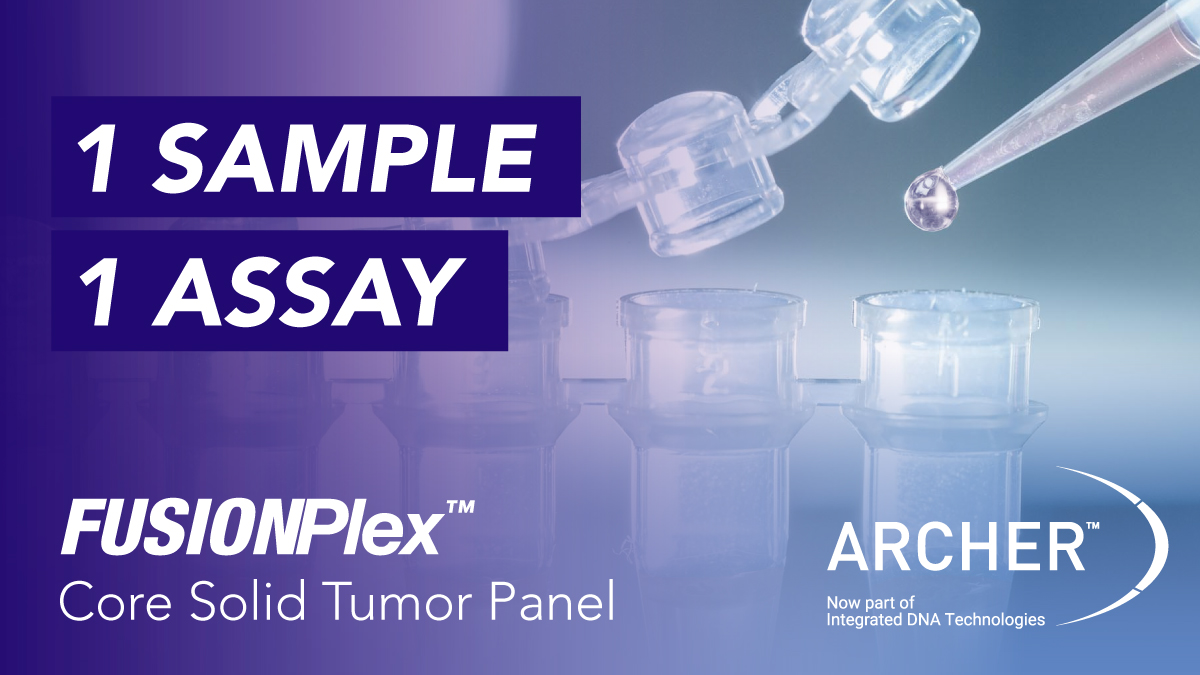 idtdna's tweet photo. Stop delaying cancer identification. Start doing more with less. 

#IDT’s #Archer™ FUSIONPlex™ Core Solid Tumor Panel only requires 1 sample and 1 assay to identify #fusions, #SNVs, and #indels. Learn more here: https://t.co/OM9jdT08Pl

#NGS #cancerresearch #oncologyresearch https://t.co/MhbbRR9Lf4
