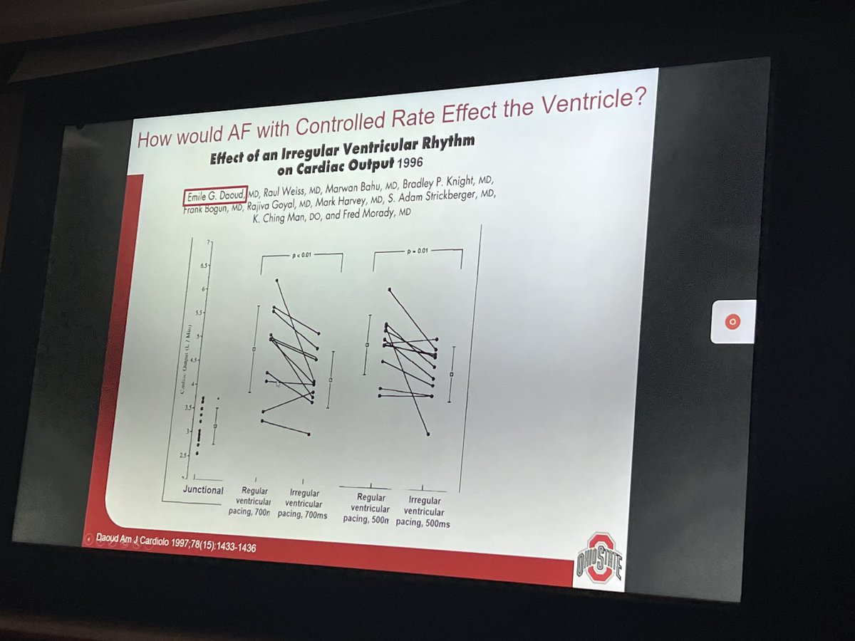 Nishaki Mehta MD (@nishaki1) on Twitter photo Loved this paper Emile Daoud discussed on back to bench to understand impact of >50% AF burden on ventricular function jacc.org/doi/abs/10.101…
Thanks for a fab grand rounds and processor rounds reviewing role of anticoagulation w device detected a fib. Loved this paper Emile Daoud discussed on back to bench to understand impact of >50% AF burden on ventricular function jacc.org/doi/abs/10.101…
Thanks for a fab grand rounds and processor rounds reviewing role of anticoagulation w device detected a fib.