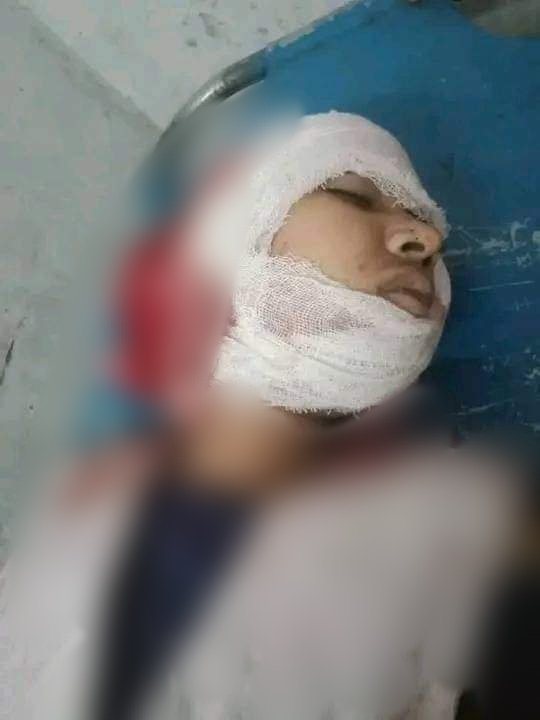 12 years old Mukti Rani, belonging to the endangered minority Hindu community of Bangladesh, was returning home after giving her school exam. Mohammed Kaucher Mia wanted to make her s€x slave. When she protested he hacked her to d€ath. The incident took place in Barhatta