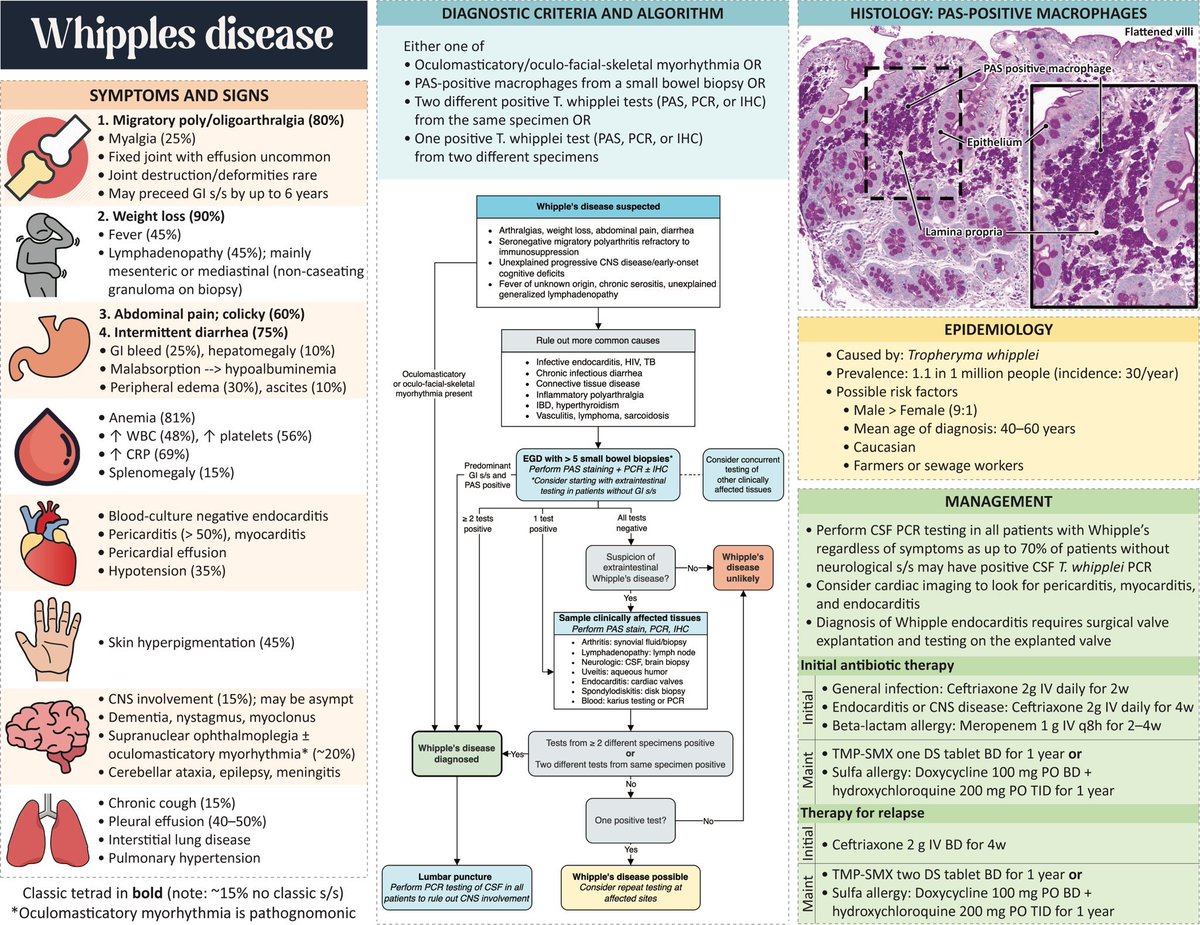 Keith Siau (@drkeithsiau) on Twitter photo <a href="/doctorsaluja/">Sandeep Saluja</a> <a href="/GeorgeGeorgemg/">George Magalhaes</a> Whipple’s is an excellent shout - multisystemic and can cause a hyperpigmented rash, but usually causes white tipped duodenal villi vs ulceration 👍
Infographic via <a href="/MatthewHoMD/">Matthew Ho</a> <a href="/doctorsaluja/">Sandeep Saluja</a> <a href="/GeorgeGeorgemg/">George Magalhaes</a> Whipple’s is an excellent shout - multisystemic and can cause a hyperpigmented rash, but usually causes white tipped duodenal villi vs ulceration 👍
Infographic via <a href="/MatthewHoMD/">Matthew Ho</a>