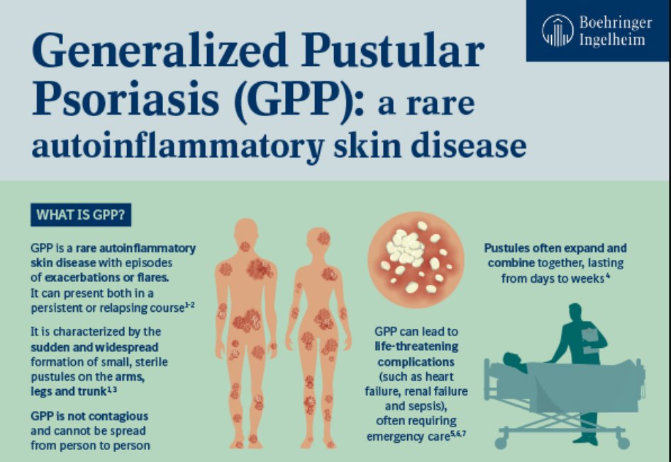 Practical_Derm's tweet photo. JUST IN: @Boehringer Ingelheim's #spesolimab has been approved by regulatory authorities in almost 40 countries to treat GPP flares in adults. #pustularpsoriasis https://t.co/37Jfi7HQTM https://t.co/4it2Ewtp1H