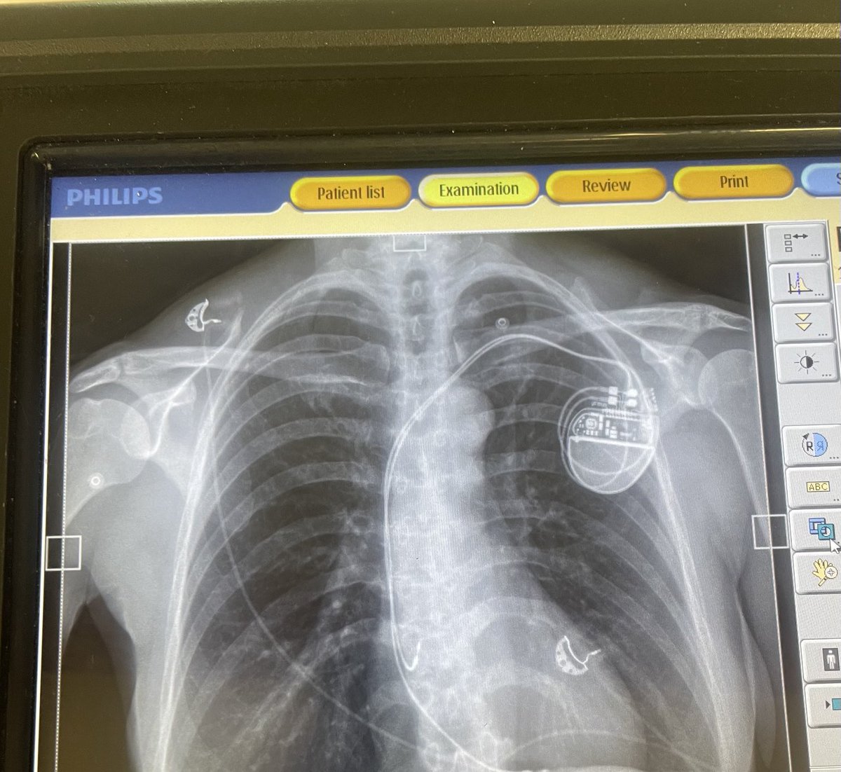 Fritz Bolten tweet media