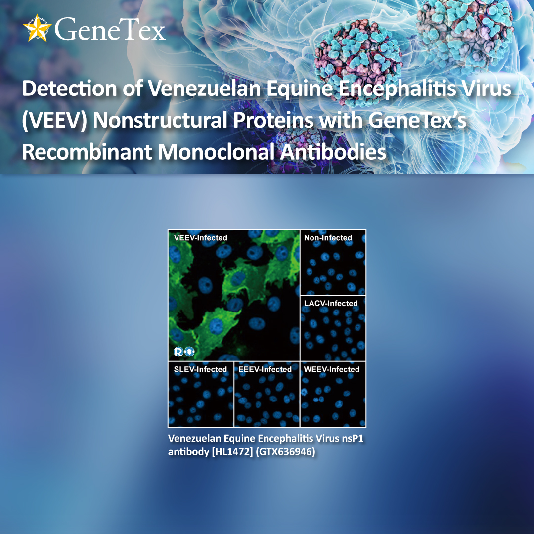 genetexinc's tweet photo. Venezuelan equine encephalitis virus (VEEV) is one of the three major encephalitic alphaviruses (the others being Eastern Equine Encephalitis Virus (EEEV) and Western Equine Encephalitis Virus (WEEV)) that can cause severe...
🔗https://t.co/hYwCNOht5T
#GeneTex #VEEV #EEEV https://t.co/Tl3Kgl0XHK