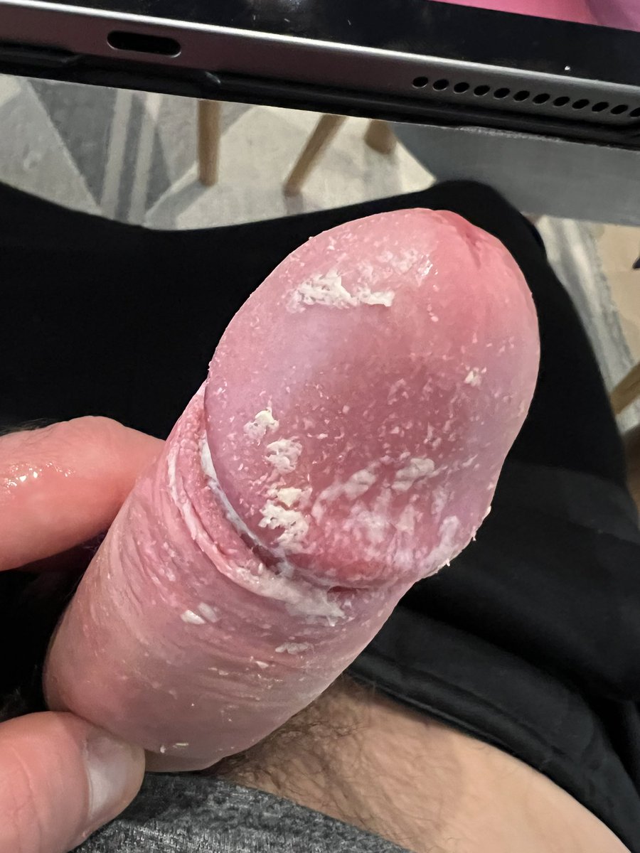 ricky_raw's tweet photo. Ready to spread the cheese #smegma #cockcheese #dickcheese #unwashedcock https://t.co/rtmxMD4aXf