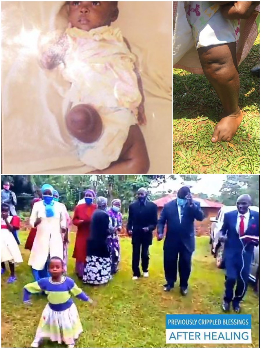 JamesGichuru14's tweet photo. #TheMightyBloodOfJesus
Made all the difference in the life of this precious girl. How else can we explain this. 

HEAVEN we must go, https://t.co/mQC4Zdgsmx