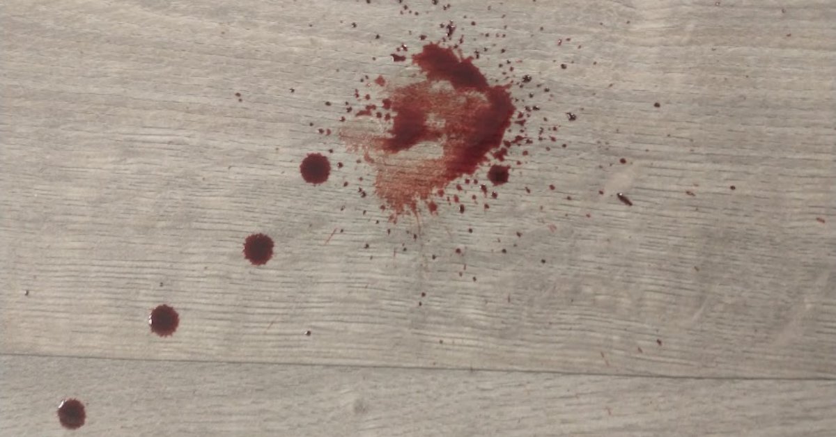 ForensicAccess's tweet image. Our next #bloodpattern analysis awareness for scenes course is on Monday 22nd May. 

This course offers a general understanding of #bloodpattern analysis to #undergraduate and #postgraduate students.

Contact us: ow.ly/TJVC50NPaWp

#forensicscientists #forensicsexpert