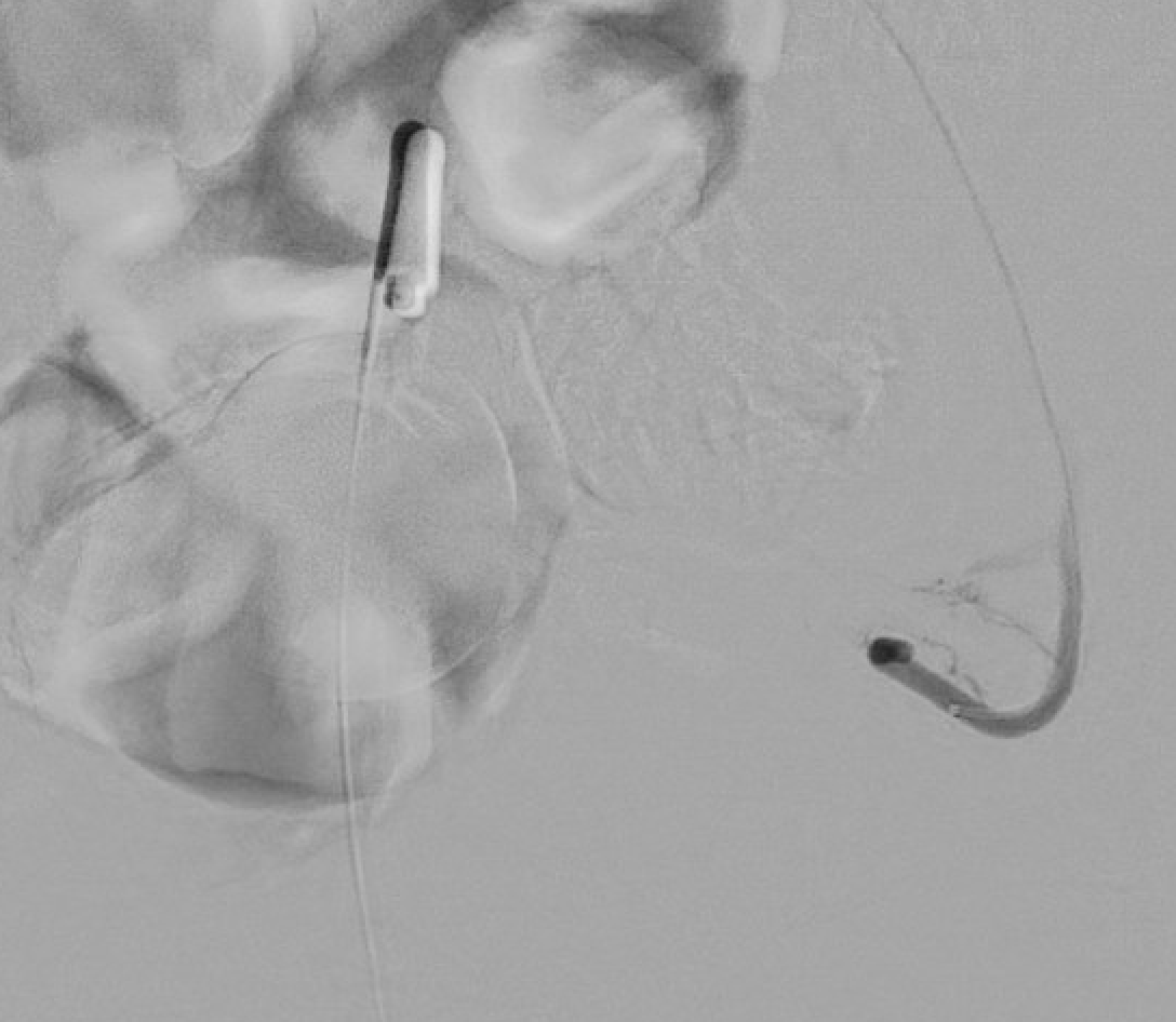 CIRSE European Trainee Forum tweet media