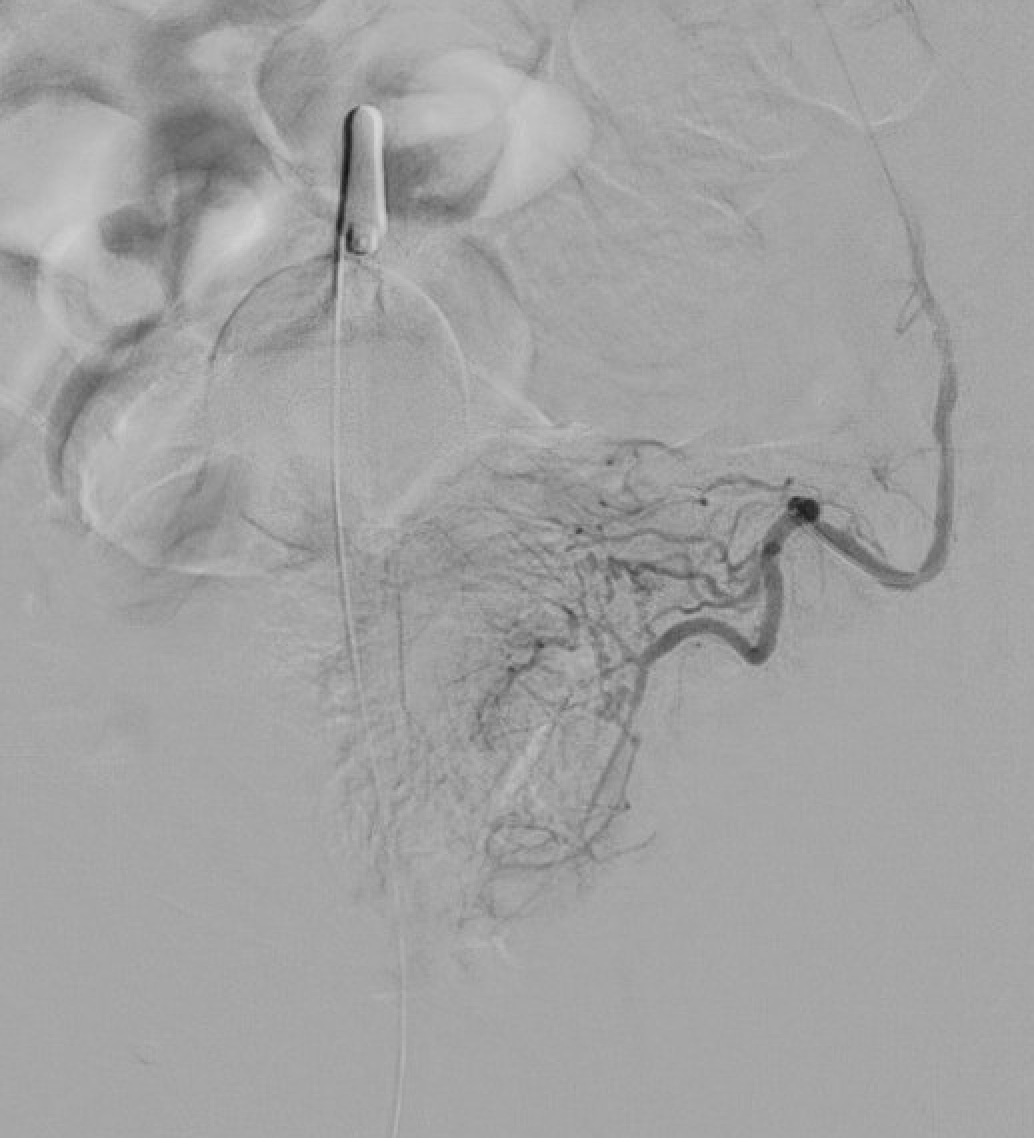 CIRSE European Trainee Forum tweet media