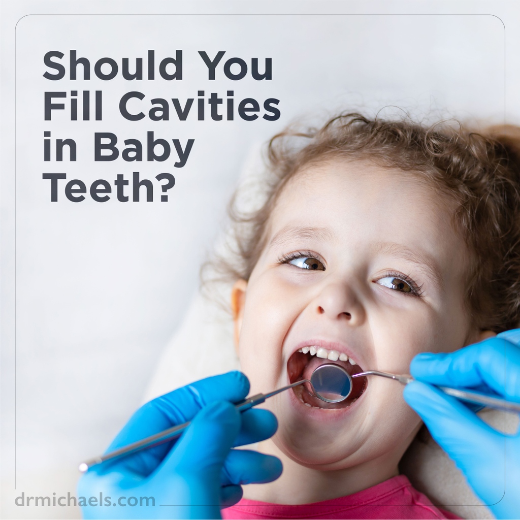 doctor_michaels's tweet image. As parents, we all want the best for our #littleones, but when it comes to #cavities in baby teeth, it's natural to have doubts.

Don't worry, we've got you covered!

Click here to find out what you can do to give your child a healthy and happy smile: bit.ly/3NyFPc0