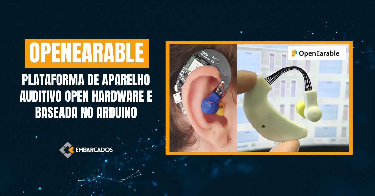 embarcados's tweet photo. Conheça o OpenEarable, um kit de desenvolvimento para aparelho auditivo, open source hardware e baseado em Arduino.

Fabio Souza

Saiba mais: https://t.co/WkS8EYcqXR

#PortalEmbarcados #SistemasEmbarcados #openearable #arduino #hardware #opensource https://t.co/5B8Ql9HsnD