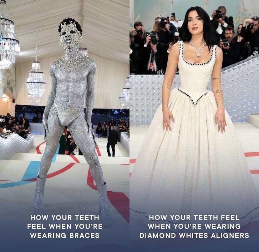 We just had too… #MetGala #diamondwhitesaligners