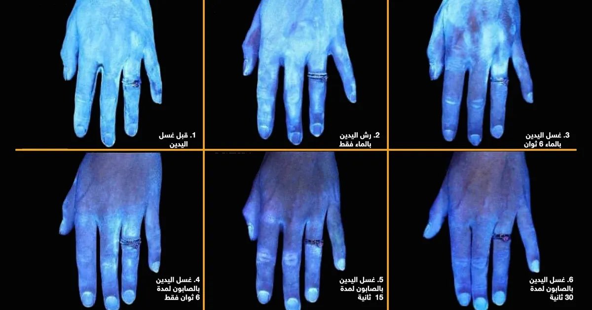 اجراء بسيط وغير مكلف لايشغلك عن اداء واجباتك، ينقذ ارواح ويمنع من حدوث الامراض ويحميك من الاصابة.

هو تطهير اليدين بالكحول او الماء والصابون،
يوم الجمعة الموافق 5 May هوا اليوم العالمي لنظافة اليدين ساهم في نشر الوعي و #خليك_واعي. 

#handhygiene 
#cleanYourHands