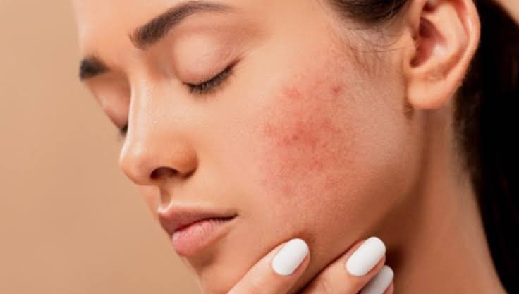 dr_saaheb's tweet photo. I love ❤️ my skin do you love
your skin ??
#drvinaykr #dermatogy #cometology #aestheticsdoctor #skindoctor #ghaziabad #Twitter https://t.co/6W2e8Z1gDW