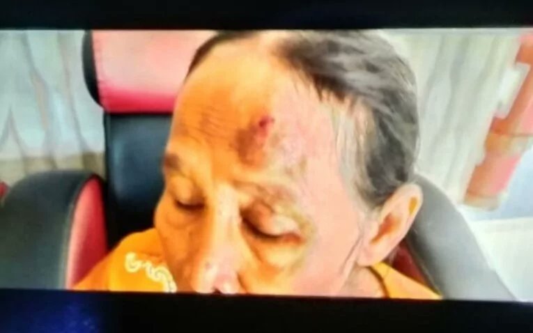 cerita0511_'s tweet photo. Gambut Kab Banjar Kalsel, Seorang ART lansia mengalami luka di dahi usai dianiaya oknum polisi yang merupakan majikannya.

Oknum tersebut diketahui berdinas di Polresta Banjarmasin

Harus viral ini biar cepat prosesnya https://t.co/in9UdTCAzb