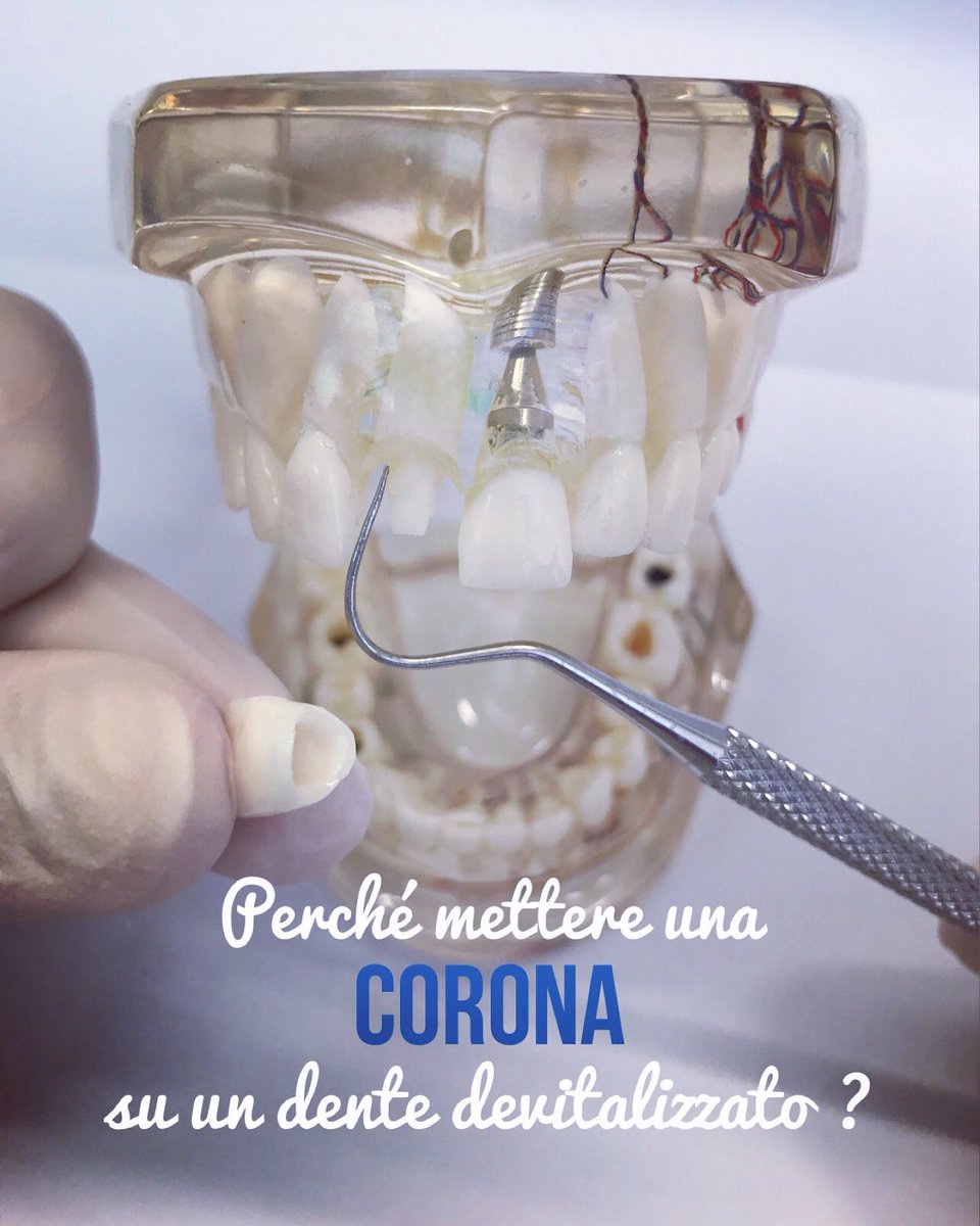 r_monguzzi's tweet photo. Un dente devitalizzato è particolarmente fragile e rischia di fratturarsi diventando potenzialmente irrecuperabile e quindi da estrarre.
Siamo a Milano zona Rovereto
☎️ 0226145657-3888402092
#coronedentali #protesidentale #dentistamilano #odontoiatria #impiantidentali https://t.co/tDlFWgrUmm