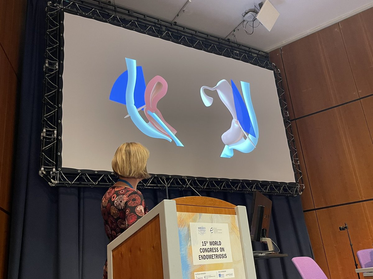 WendalineVB's tweet photo. Dr. Sophie Piessens on mastering #Endometriosis imaging of the uterosaccral ligaments - probe in the posterior fornix is key! @WorldEndoSoc #WCE2023 @MathewLeonardi @AliUltrasound @horne_research @VimeeBindra @MayoRadiology @sruradiology @AIUMultrasound https://t.co/D5AriylgTV