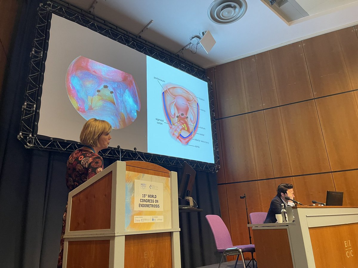 WendalineVB's tweet photo. Dr. Sophie Piessens on mastering #Endometriosis imaging of the uterosaccral ligaments - probe in the posterior fornix is key! @WorldEndoSoc #WCE2023 @MathewLeonardi @AliUltrasound @horne_research @VimeeBindra @MayoRadiology @sruradiology @AIUMultrasound https://t.co/D5AriylgTV