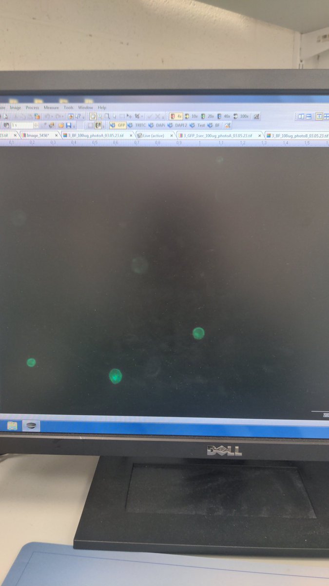 Just a few green dots means great success in the lab!! After quite a bit of trouble shooting I managed to set up protoplast transfections here at Maynooth-see the GFP below! Choice of vector backbone/promoter was key. LOTS of plans with this system!