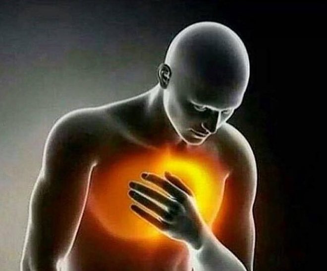 pedropov_'s tweet photo. yo cuando trago lava: https://t.co/SihDbFnfil