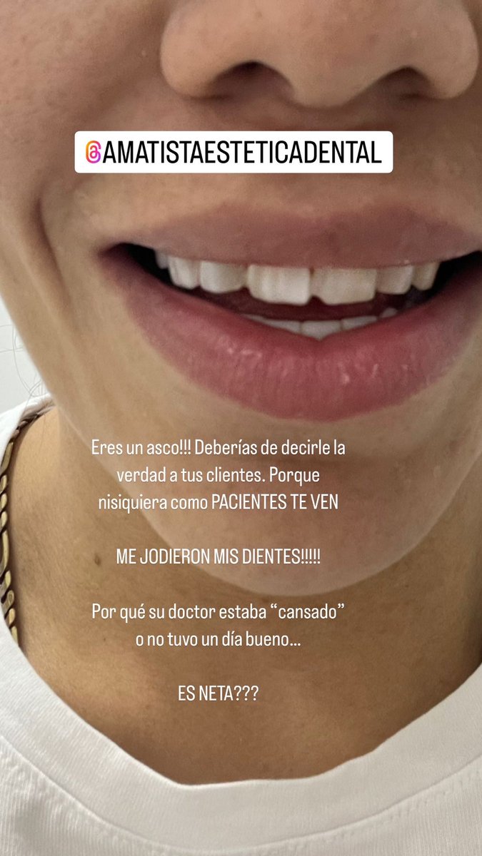 mo0ntss's tweet photo. Subiré story time en tik tok… por favor ayúdenme a que mas personas no caigan en estas manos de gente sin escrúpulos!!!!!! #mearruinaronlosdientes https://t.co/lbRO0RfyWd