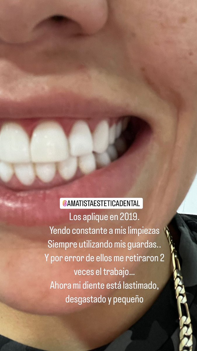 mo0ntss's tweet photo. Subiré story time en tik tok… por favor ayúdenme a que mas personas no caigan en estas manos de gente sin escrúpulos!!!!!! #mearruinaronlosdientes https://t.co/lbRO0RfyWd